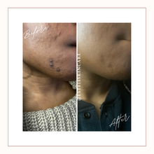 Load image into Gallery viewer, Kojic Acid Dark Spot Serum